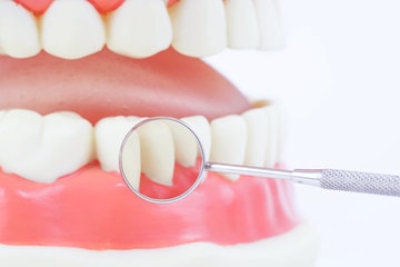 歯周形成外科