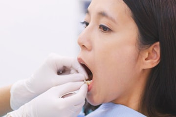 歯周組織管理
