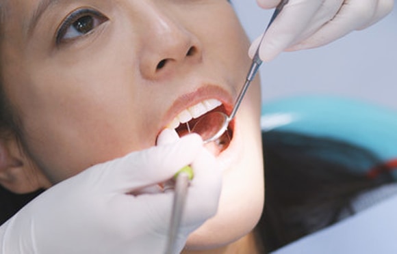 歯周病基本治療